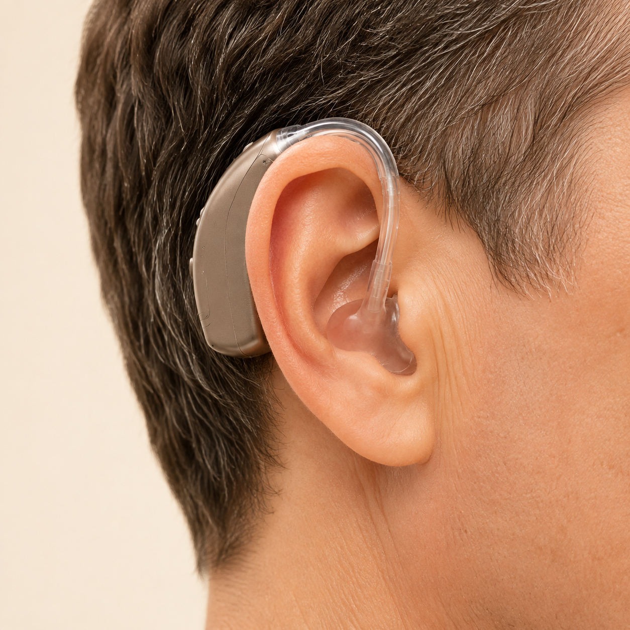 Behind-the-ear hearing aid connected to a custom earmold