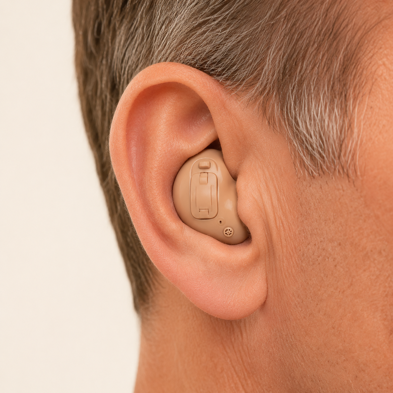 Custom in-the-ear hearing aid filling the outer ear
